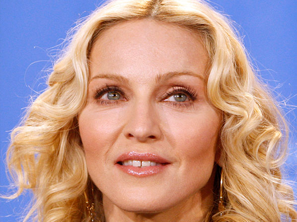 madonna diastema